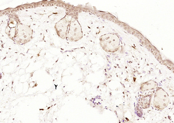 Phospho-BRCA1 (Ser1189) Rabbit Polyclonal Antibody