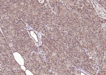 RAD9 Rabbit Polyclonal Antibody
