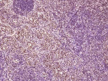 Phospho-RAD9 (Tyr28) Rabbit Polyclonal Antibody