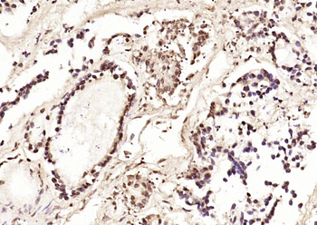 Phospho-RAD51 (Thr309) Rabbit Polyclonal Antibody