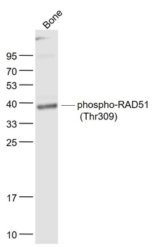 Phospho-RAD51 (Thr309) Rabbit Polyclonal Antibody