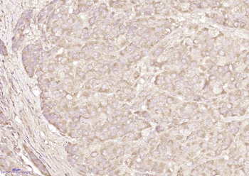 CAPZA1 Rabbit Polyclonal Antibody