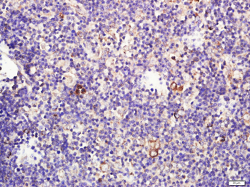 CCL25 Rabbit Polyclonal Antibody