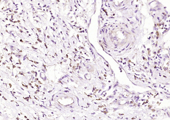 RelB Rabbit Polyclonal Antibody