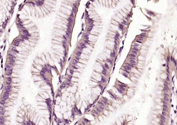 TRAK1 Rabbit Polyclonal Antibody