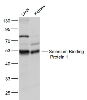 Selenium Binding Protein 1 Rabbit Polyclonal Antibody