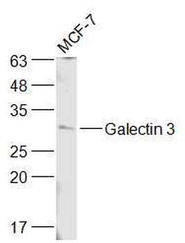 Galectin 3 Rabbit Polyclonal Antibody (HRP)