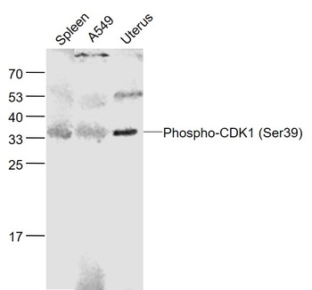 cdc2 (phospho-Ser39) antibody