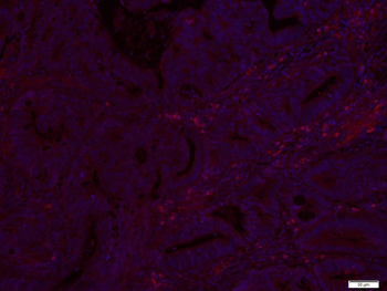 BAMBI Rabbit Polyclonal Antibody (PE)