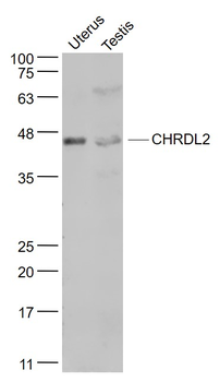 CHRDL2 Rabbit Polyclonal Antibody