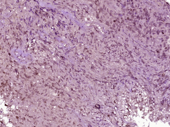 Phospho-Cofilin (Tyr89) Rabbit Polyclonal Antibody