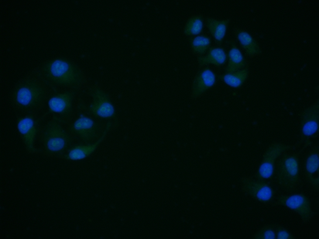 CREM Rabbit Polyclonal Antibody