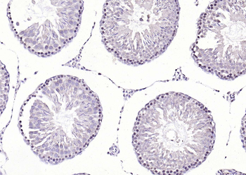 CREM Rabbit Polyclonal Antibody