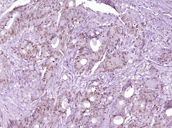 Histone H3 (tri methyl K9) Mouse Monoclonal Antibody