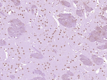 Histone H3 (tri methyl K9) Mouse Monoclonal Antibody