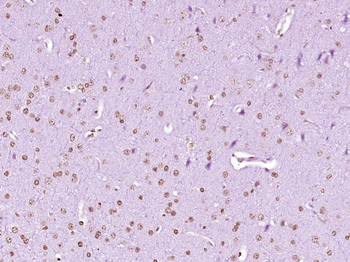 Histone H3 (tri methyl K9) Mouse Monoclonal Antibody
