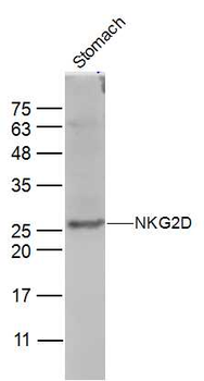 NKG2D Rabbit Polyclonal Antibody