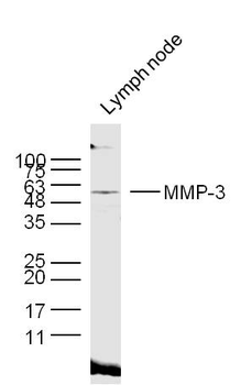 MMP3 Rabbit Polyclonal Antibody
