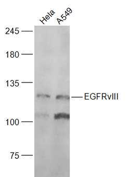 EGFRvIII Rabbit Polyclonal Antibody