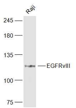 EGFRvIII Rabbit Polyclonal Antibody
