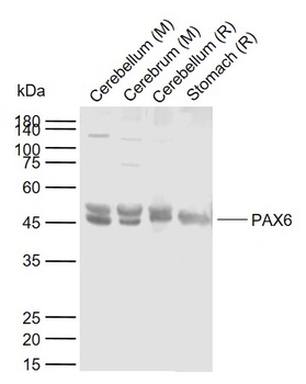 PAX6 antibody