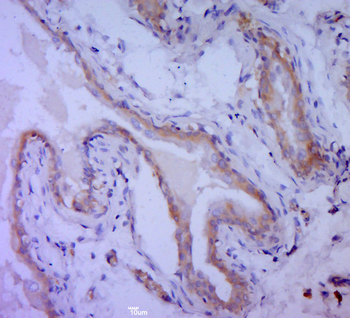 Bcl-2 Rabbit Polyclonal Antibody
