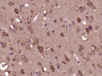 YIPF3 Rabbit Polyclonal Antibody