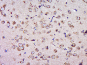 PTPRS Rabbit Polyclonal Antibody