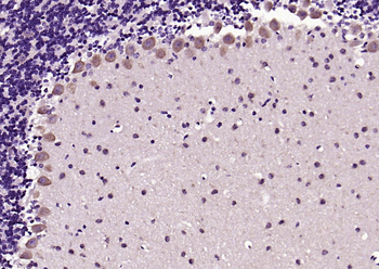 PSD95 Rabbit Polyclonal Antibody