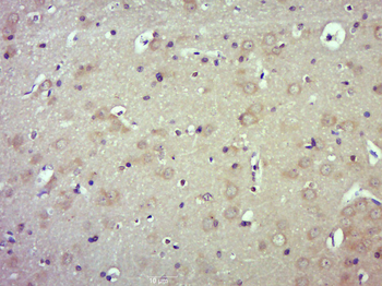 PSD95 Rabbit Polyclonal Antibody