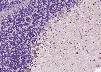 PSD95 Rabbit Polyclonal Antibody