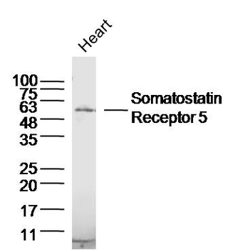 Somatostatin Receptor 5 Rabbit Polyclonal Antibody