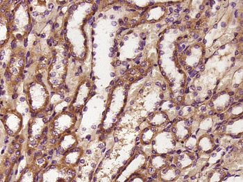 ASB5 Rabbit Polyclonal Antibody