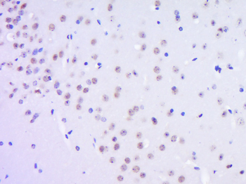 GPR30 Rabbit Polyclonal Antibody