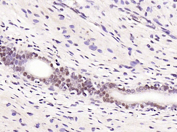 GPR30 Rabbit Polyclonal Antibody