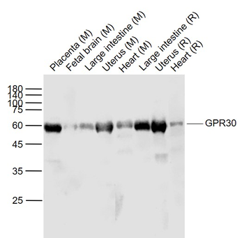GPR30 Rabbit Polyclonal Antibody