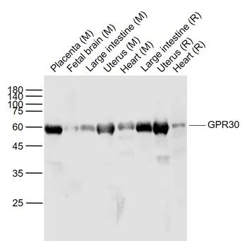 GPR30 antibody