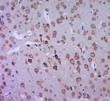 Jagged1/CD339 Rabbit Polyclonal Antibody