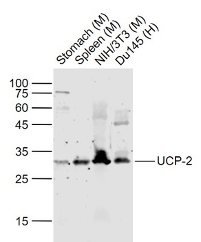 UCP-2 antibody