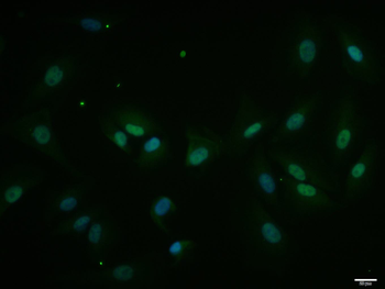 Ku70 / XRCC6 Rabbit Polyclonal Antibody