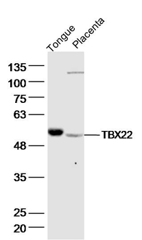 TBX22 Rabbit Polyclonal Antibody