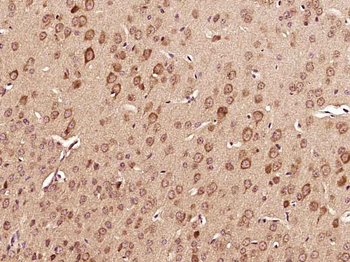 CRF Rabbit Polyclonal Antibody