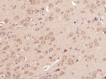CRF Rabbit Polyclonal Antibody