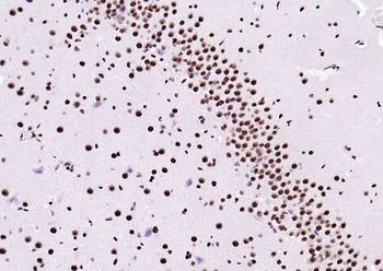 Beclin 1 Mouse Monoclonal Antibody