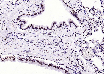 Beclin 1 Mouse Monoclonal Antibody