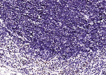 Beclin 1 Mouse Monoclonal Antibody