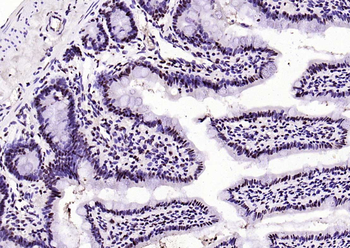 Beclin 1 Mouse Monoclonal Antibody