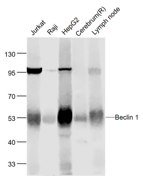 Beclin 1 Mouse Monoclonal Antibody
