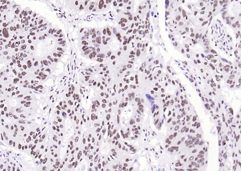 Beclin 1 Mouse Monoclonal Antibody