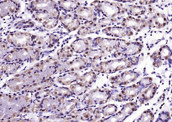 Beclin 1 Mouse Monoclonal Antibody